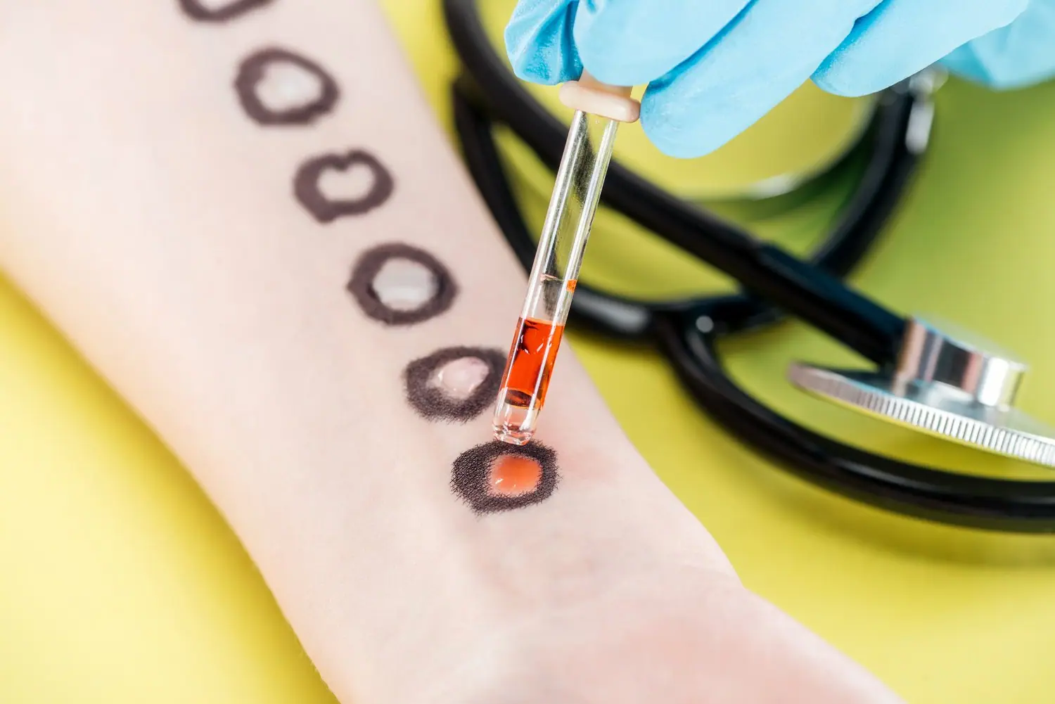 Cholesterol HDL i LDL: Jak interpretować wyniki i co robić przy odchyleniach?